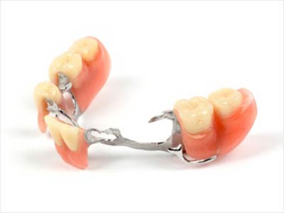 Clinique Cloutier denturologiste Montréal | Prothèses partielles